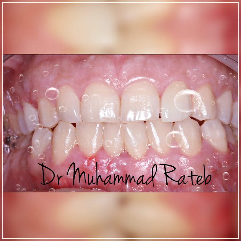 دكتور محمود راتب اخصائى تقويم و زراعة الاسنان Dr Muhamed Rateb Dental Clinic دليل الزقازيق