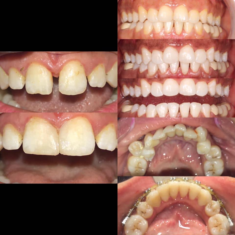 غلاف مركز البنا لطب وتقويم الفم والاسنان